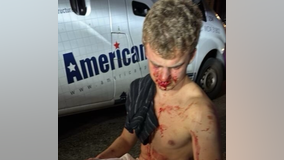 Who is 'Big Balls' Edward Coristine, the former DOGE employee beaten in DC?