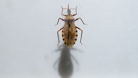 Deadly 'kissing bug' disease becoming endemic in the US: CDC