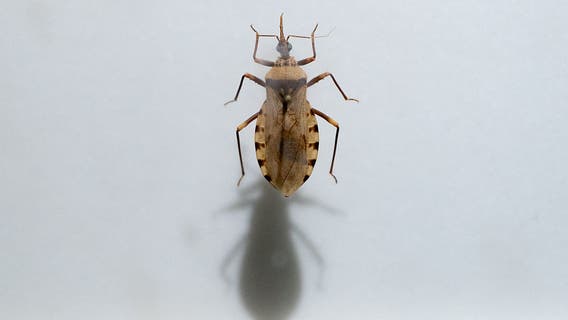 Deadly 'kissing bug' disease becoming endemic in the US: CDC