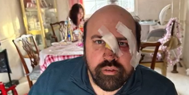 Maryland special education teacher recovering after being hit by car while helping others