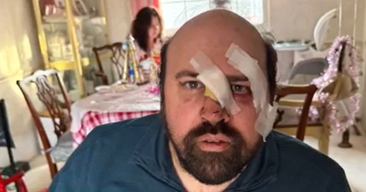 Maryland special education teacher recovering after being hit by car while helping others