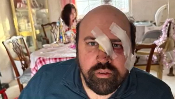 Maryland special education teacher recovering after being hit by car while helping others