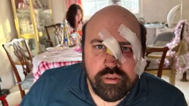 Maryland special education teacher recovering after being hit by car while helping others