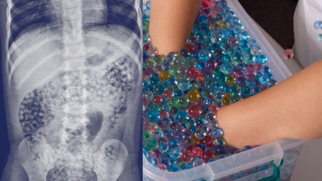 Some water beads 'illegal' in US as federal safety rules go into effect