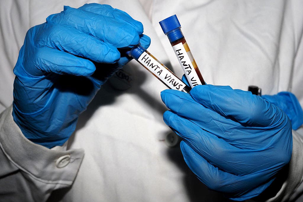Maryland monitors 2 residents after possible hantavirus exposure on flight