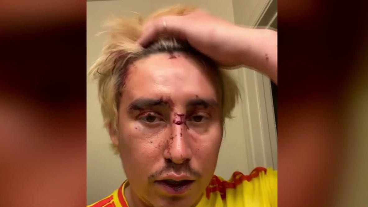 Man needs staples in head after attack on Metro train on Cinco de Mayo