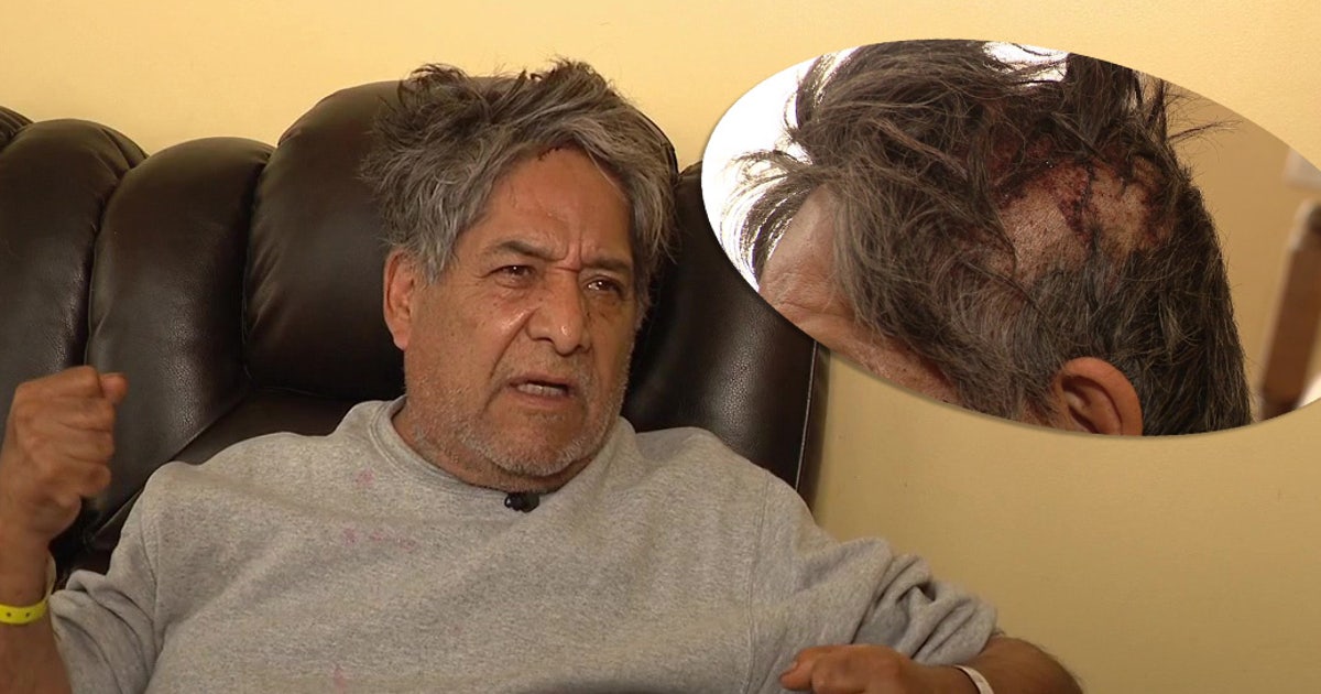 Vietnam vet attacked with crowbar believes he was targeted in hate crime