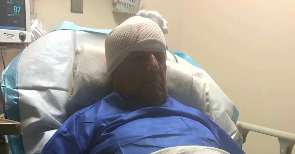 Vietnam vet attacked with crowbar believes he was targeted in hate crime