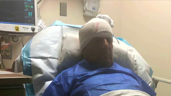 76-year-old veteran brutally attacked at laundromat