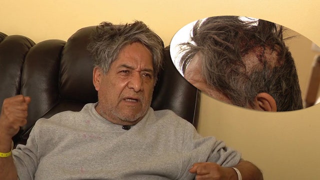 Vietnam vet attacked with crowbar believes he was targeted in hate crime