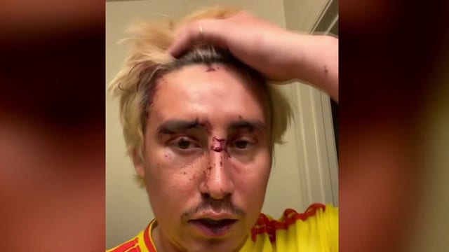 Man needs staples in head after attack on Metro train on Cinco de Mayo