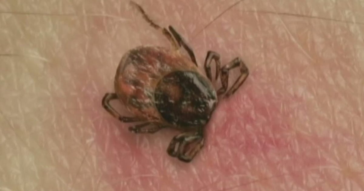 NYC's tick attack plan aims at Staten Island | FOX 5 New York