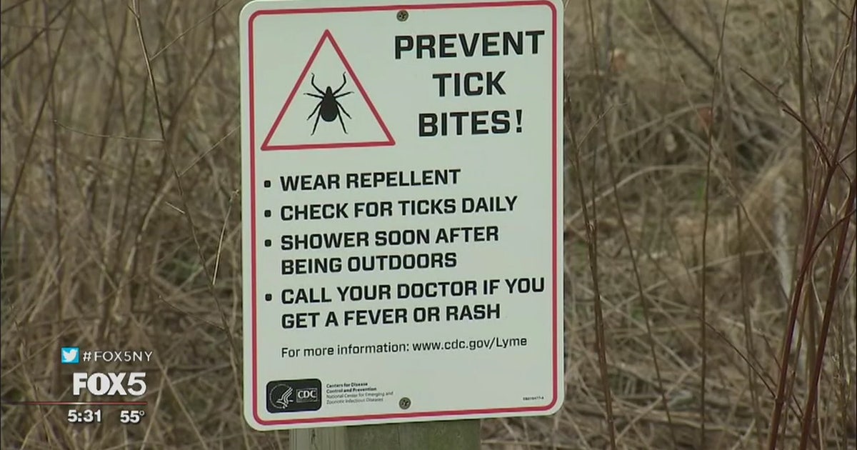 Tick season has begun | FOX 5 New York