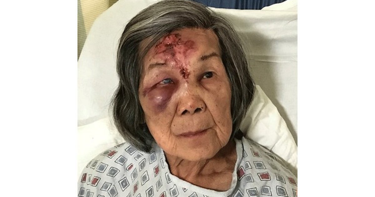 Cops need help identifying elderly woman | FOX 5 New York