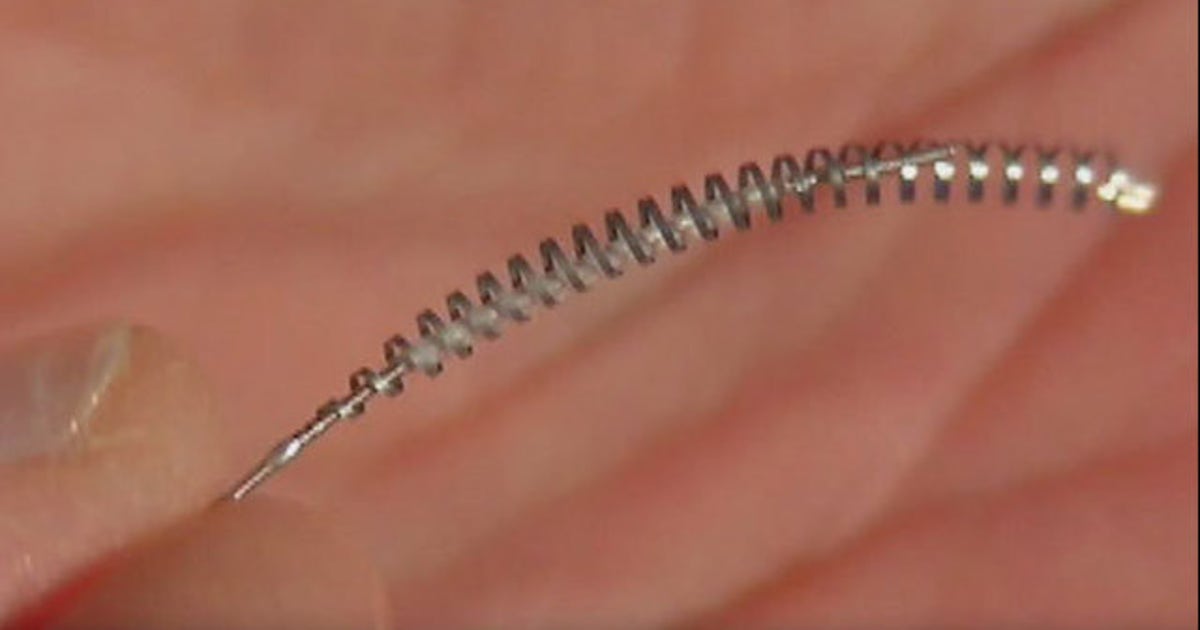 Bayer to stop sales of Essure birth control device tied to injuries ...