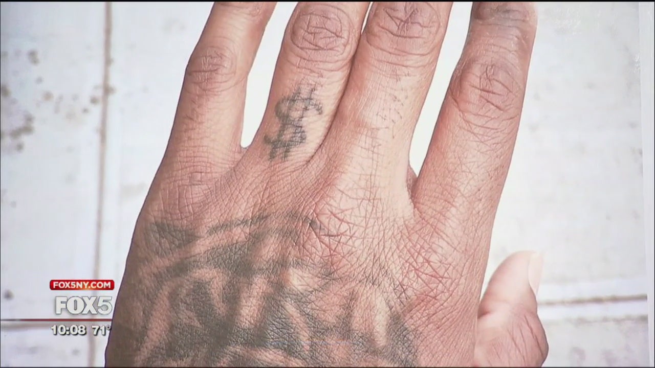 Free Tattoo Removal For Sex Trafficking Survivors In Nyc 