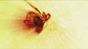 New Lyme disease test being developed