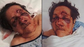 86-year-old woman assaulted at nursing home, son claims