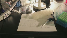 The Big Idea: Multiple sclerosis clinical trial shows promise