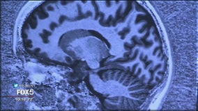 Prayer triggers brain rewards