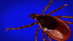 Tick bite proves fatal for Minnesota man