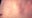 Measles cases confirmed in NJ, NY as US reports first death