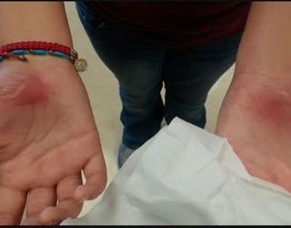 Burned in Gym Class1_1442181615373_200191_ver1.0_640_360_1442240578525-409650.jpg