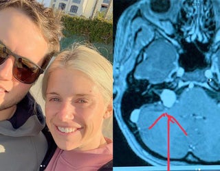 Kelly Stafford To Have Brain Surgery Wednesday Brother Says