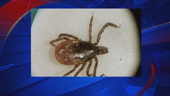 Study: High-risk areas for Lyme disease are growing