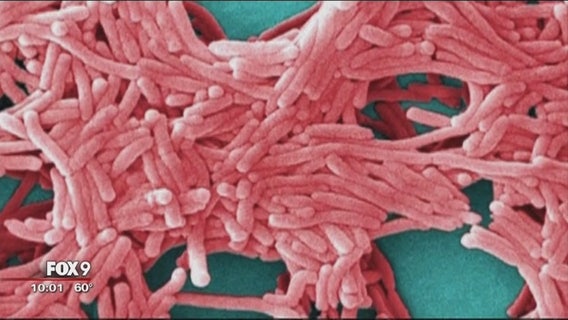 Hot tubs at state fair blamed for deadly Legionnaires' disease outbreak