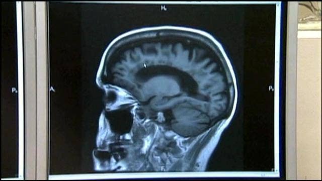 Are youth sports safe to play? | Fox Docs