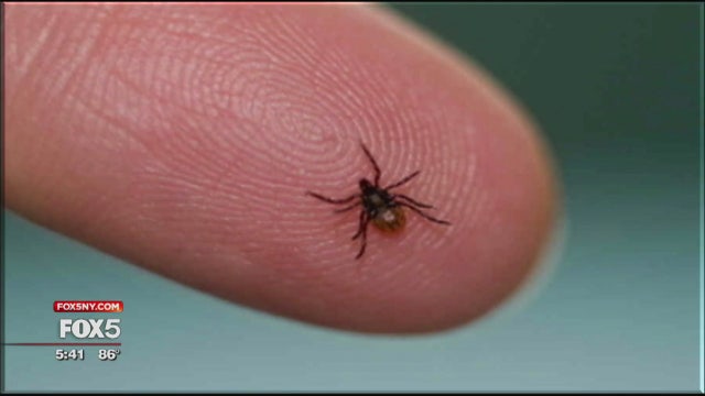 Hundreds on Long Island develop red meat allergy from tick bites