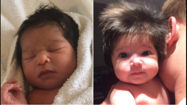 4-month-old baby has full head of hair