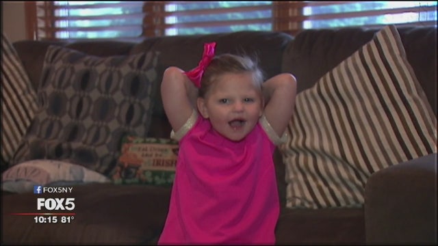 Living with microcephaly