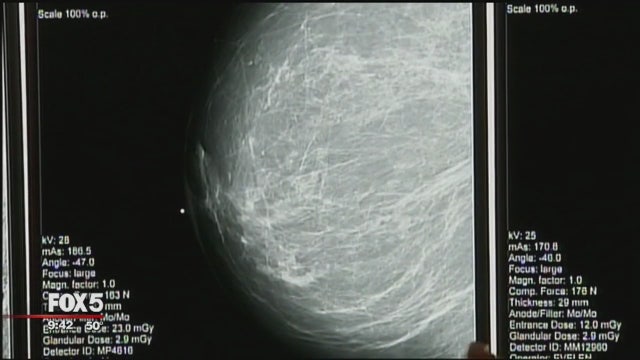 New mammogram technique promises less discomfort