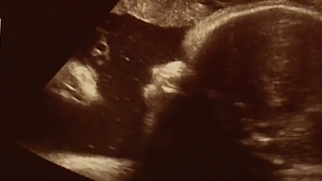 Couple sees 'Jesus' in baby's sonogram