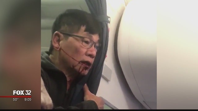 Doctor dragged off United flight reaches settlement with airline