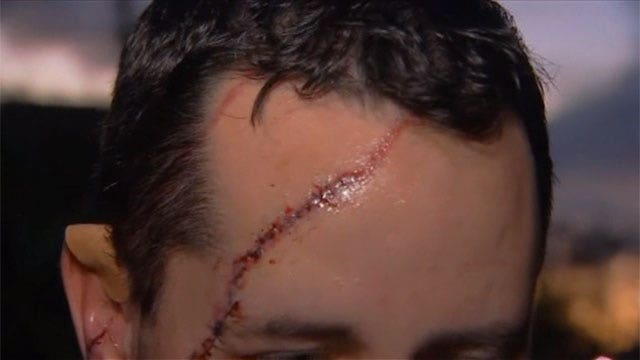 Bear attacks man who let his dog out for a walk