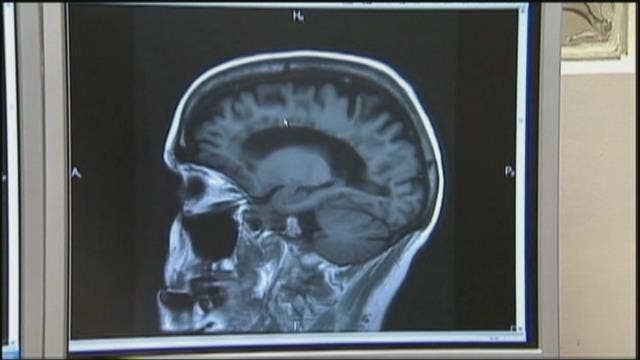 Doctor won't let son play football due to concussion concerns
