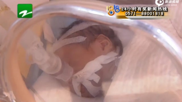 Baby who was declared dead wakes up just before he's to be cremated