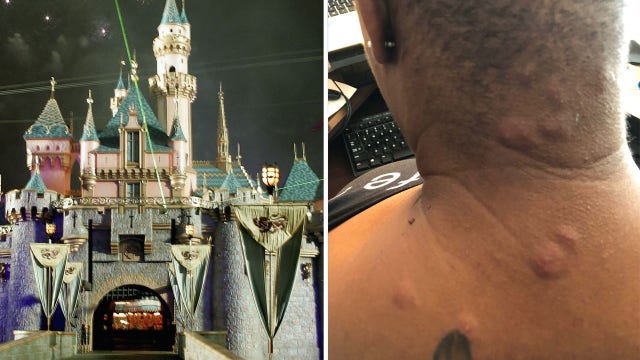 Disneyland Hotel accused of bedbugs in woman's lawsuit