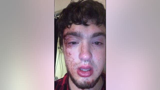 Police investigate possible anti-gay beating