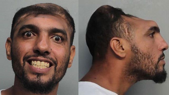 Half-headed man faces attempted murder charges