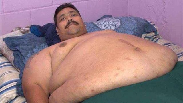1,000 lbs. man to undergo weight-loss surgery