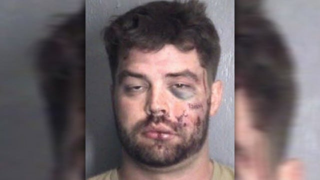 Would-be burglar beaten by NC resident after breaking into home