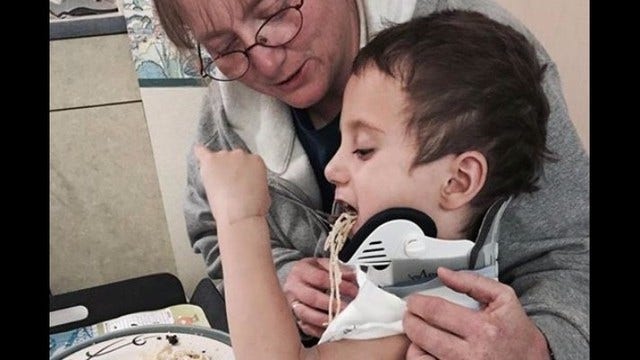 4-year-old boy survives internal decapitation