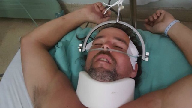 Florida man paralyzed after chasing monkey that stole his hat