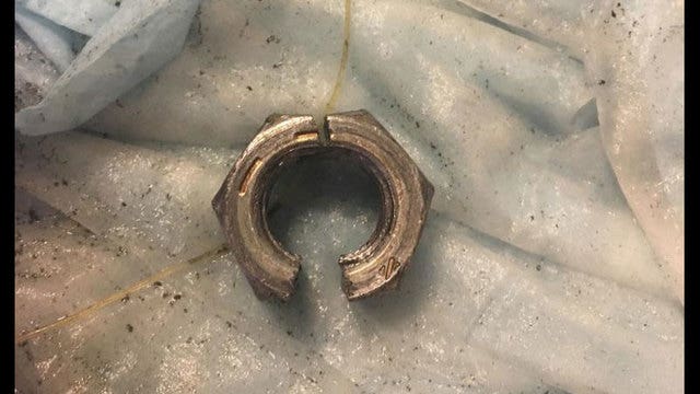 Firefighters remove steel nut stuck on 5-year-old's finger