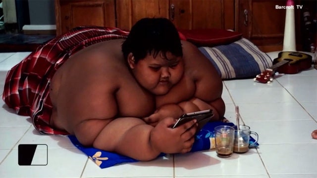 10-year-old weighs 423 pounds