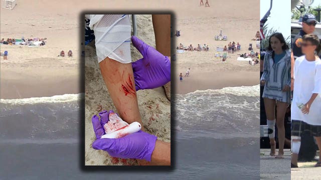 Children survive shark attacks off Fire Island